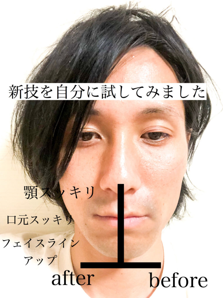 三重県四日市市ドライヘッドスパ Re:st レスト｜小顔の技術を自分に試してみた結果